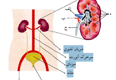 نفروپاتی دیابتی